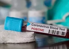 شیوع ویروس کرونا در اروپا