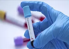 شیوع ویروس کرونا